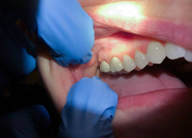 Best Cosmetic Emergency Dentistry in Stony Point, NC