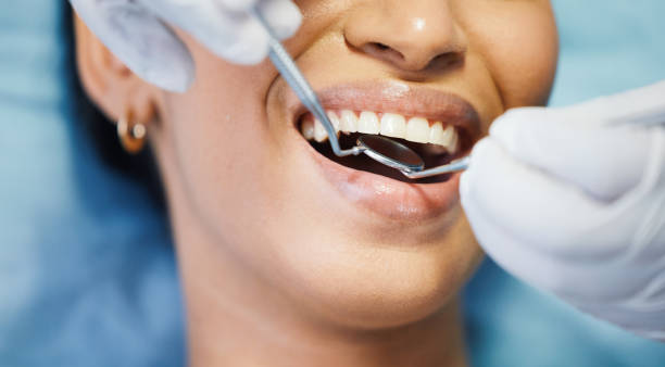 Best Emergency Denture Repair in Stony Point, NC