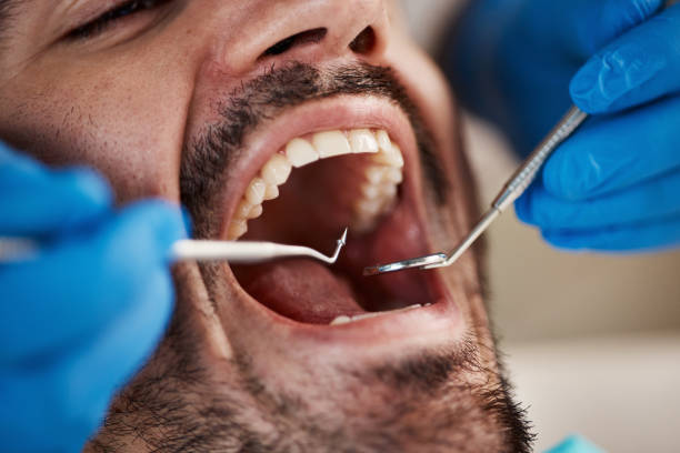 Best Same-Day Emergency Dental Services in Stony Point, NC